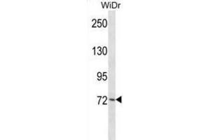 Western Blotting (WB) image for anti-Polo-Like Kinase 3 (PLK3) antibody (ABIN2998167) (PLK3 Antikörper)
