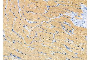 ABIN6266284 and ABIN6277438 at 1/100 staining Rat muscle tissue by IHC-P. (TPM2 Antikörper  (C-Term))