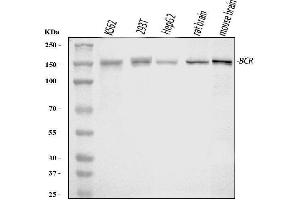 Western blot analysis of Bcr using anti-Bcr antibody (ABIN4886483). (BCR Antikörper  (AA 1-100))