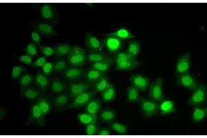 Immunofluorescence analysis of U2OS cells using MAD1L1 Polyclonal Antibody (MAD1L1 Antikörper)