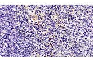 Detection of IL8 in Human Spleen Tissue using Monoclonal Antibody to Interleukin 8 (IL8) (IL-8 Antikörper  (AA 28-99))