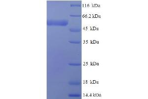 SDS-PAGE (SDS) image for Isocitrate Dehydrogenase 3 (NAD+) gamma (IDH3G) (AA 40-393) protein (His-SUMO Tag) (ABIN5709701)