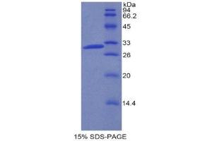 SDS-PAGE (SDS) image for Coagulation Factor V (F5) (AA 1776-2028) protein (His tag) (ABIN1877701) (Coagulation Factor V Protein (F5) (AA 1776-2028) (His tag))