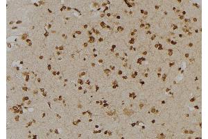 ABIN6277006 at 1/100 staining Human brain tissue by IHC-P. (PSMD2 Antikörper  (C-Term))