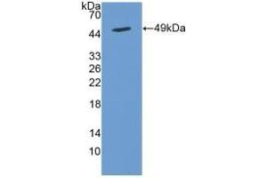 Detection of Recombinant CYTH2, Human using Polyclonal Antibody to Cytohesin 2 (CYTH2) (Cytohesin 2 Antikörper  (AA 1-390))