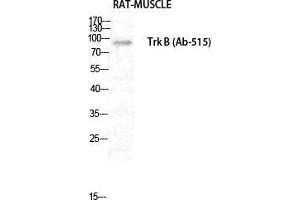 Western Blot (WB) analysis of Rat Muscle cells using Trk B Polyclonal Antibody. (TRKB Antikörper  (Thr185))