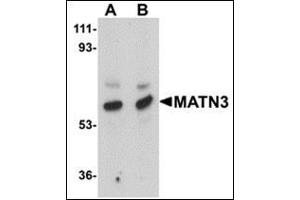 Western blot analysis of MATN3 in rat thymus tissue lysate with this product at (A) 1 and (B) 2 μg/ml.
