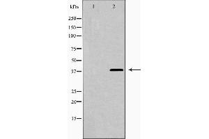 Western blot analysis of LEG9 expression in HepG2 cells,The lane on the left is treated with the antigen-specific peptide. (Galectin 9 Antikörper  (Internal Region))