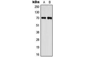 Western blot analysis of CEP70 expression in A549 (A), PC12 (B) whole cell lysates. (CEP70 Antikörper  (Center))