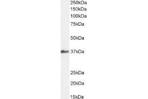 Western Blotting (WB) image for anti-E3 Ubiquitin-Protein Ligase SIAH1 (SIAH1) (N-Term) antibody (ABIN184675)