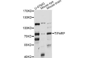 Western blot analysis of extracts of various cell lines, using TIPARP antibody (ABIN6292494) at 1:1000 dilution. (Tiparp Antikörper)