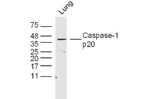 Rat lung lysates probed with Caspase-1 p20 Polyclonal Antibody, Unconjugated  at 1:300 dilution and 4˚C overnight incubation.