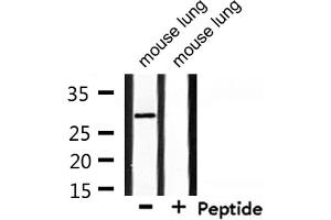 Western blot analysis of extracts from mouse lung, using RNF144A Antibody. (RNF144A Antikörper  (Internal Region))