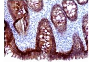 Image no. 1 for anti-Cadherin 1, Type 1, E-Cadherin (Epithelial) (CDH1) antibody (ABIN459320) (E-cadherin Antikörper)
