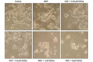 Cells were incubated in the presence or absence of 10 ng/mL NGF with or without various concentrations of K252a (ABIN7885840). (K252a)