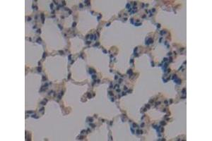 IHC-P analysis of Mouse Tissue, with DAB staining. (GSTA4 Antikörper  (AA 1-222))