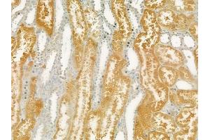 ABIN6265056 and ABIN6277707 at 1/100 staining human normal kidney tissue by IHC-P. (SH3G2 Antikörper  (Internal Region))
