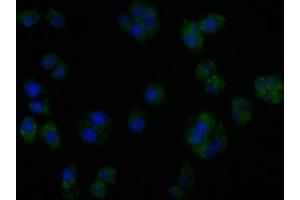 Immunofluorescence staining of PC3 cells with ABIN7140185 at 1:50, counter-stained with DAPI. (TGFBR3L Antikörper  (AA 242-258))
