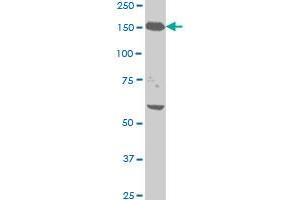 NEFH monoclonal antibody (M01), clone 2E8 Western Blot analysis of NEFH expression in HeLa . (NEFH Antikörper  (AA 263-363))