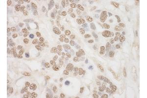 Immunohistochemistry (IHC) image for anti-Ribosomal Protein S6 Kinase A4 (RPS6KA4) (AA 722-772) antibody (ABIN7453734)
