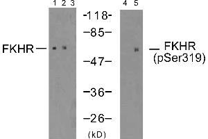 Western blot analysis of extracts using FKHR (Ab-319) antibody (Line 1, 2 and 3) and FKHR (phospho-Ser319) antibody (Line 4 and 5). (FOXO1 Antikörper  (Ser319))