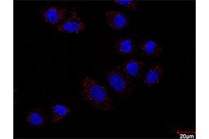 Proximity Ligation Assay (PLA) image for MAPK3 & DUSP1 Protein Protein Interaction Antibody Pair (ABIN1340128)