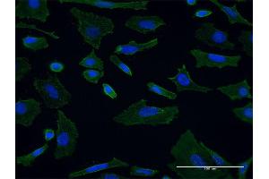 Immunofluorescence of monoclonal antibody to SH3GL1 on HeLa cell. (SH3GL1 Antikörper  (AA 1-369))