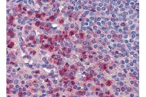 Image no. 1 for anti-Interleukin-27 Subunit alpha (IL27) (Center) antibody (ABIN372920) (IL27 Antikörper  (Center))