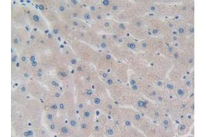 DAB staining on IHC-P;;Samples: Human Liver Tissue (PPM1A Antikörper  (AA 2-382))