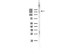 anti-Cell Migration Inducing Hyaluronan Binding Protein (CEMIP) (C-Term) antibody