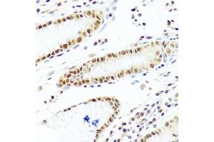 Immunohistochemistry of paraffin-embedded human stomach using PRPF19 antibody. (PRP19 Antikörper)