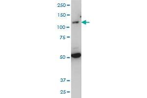 TLR7 monoclonal antibody (M04), clone 2C9 Western Blot analysis of TLR7 expression in IMR-32 . (TLR7 Antikörper  (AA 27-126))
