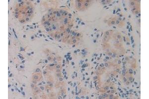 Immunohistochemistry (IHC) image for anti-Slit Homolog 1 (SLIT1) (AA 603-773) antibody (ABIN7438100)