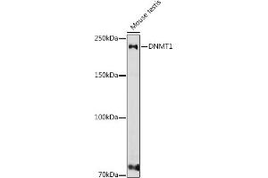 Western blot analysis of extracts of various cell lines, using DNMT1 antibody (ABIN7266810) at 1:1000 dilution. (DNMT1 Antikörper  (AA 1-270))