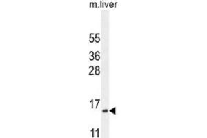 Western Blotting (WB) image for anti-Complexin 3 (CPLX3) antibody (ABIN2995755) (CPLX3 Antikörper)