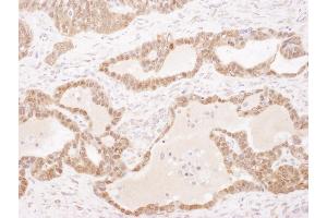 Immunohistochemistry (IHC) image for anti-Glutathione S-Transferase pi 1 (GSTP1) (AA 160-210) antibody (ABIN7453941) (GSTP1 Antikörper  (AA 160-210))