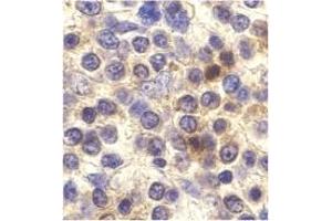 Image no. 1 for anti-Chemokine (C-X3-C Motif) Receptor 1 (CX3CR1) antibody (ABIN203578) (CX3CR1 Antikörper)