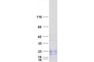 Validation with Western Blot (ZNF581 Protein (Myc-DYKDDDDK Tag))