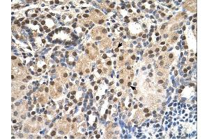 ANP32E antibody was used for immunohistochemistry at a concentration of 4-8 ug/ml. (ANP32E Antikörper)