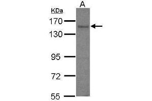 WB Image Sample (30 ug of whole cell lysate) A: IMR32 7. (AKAP1 Antikörper  (C-Term))