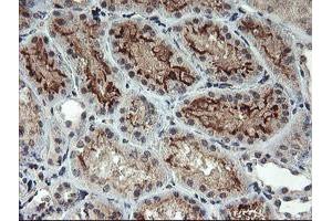 Immunohistochemical staining of paraffin-embedded Human Kidney tissue using anti-RFXANK mouse monoclonal antibody.