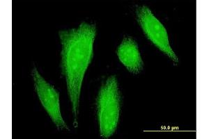 Immunofluorescence (IF) image for anti-Death-Domain Associated Protein (DAXX) (AA 561-660) antibody (ABIN514879)