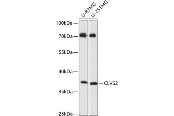 CLVS2 抗体  (AA 265-327)