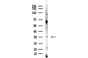 Western blot analysis of lysates from COLO205 cells, using ZDHHC7 Antibody at 1/1000 dilution.