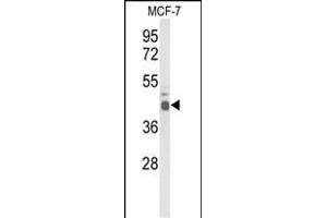 Western Blotting (WB) image for anti-E74-Like Factor 3 (Ets Domain Transcription Factor, Epithelial-Specific) (ELF3) (AA 322-349), (C-Term) antibody (ABIN653393)