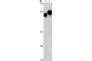 Western Blotting (WB) image for anti-Archaelysin Family Metallopeptidase 1 (AMZ1) antibody (ABIN2432515) (AMZ1 Antikörper)