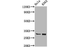 Western Blot Positive WB detected in: Hela whole cell lysate, K562 whole cell lysate All lanes: CHODL antibody at 6. (CHODL Antikörper  (AA 105-206))