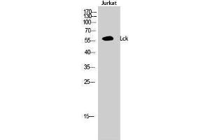Western Blotting (WB) image for anti-Lymphocyte-Specific Protein tyrosine Kinase (LCK) (Ser736) antibody (ABIN3180146) (LCK Antikörper  (Ser736))