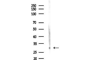 anti-Proteasome (Prosome, Macropain) Inhibitor Subunit 1 (PI31) (PSMF1) (C-Term) antibody