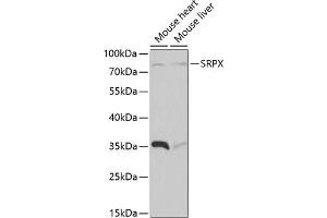 Western blot analysis of extracts of various cell lines, using SRPX antibody  at 1:1000 dilution. (SRPX Antikörper  (AA 40-320))